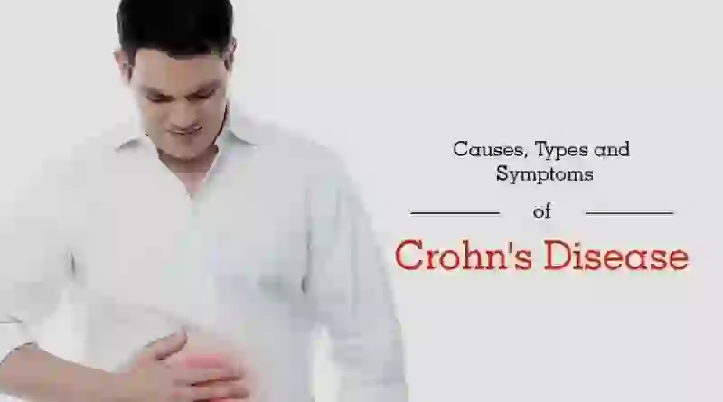 Chrons disease